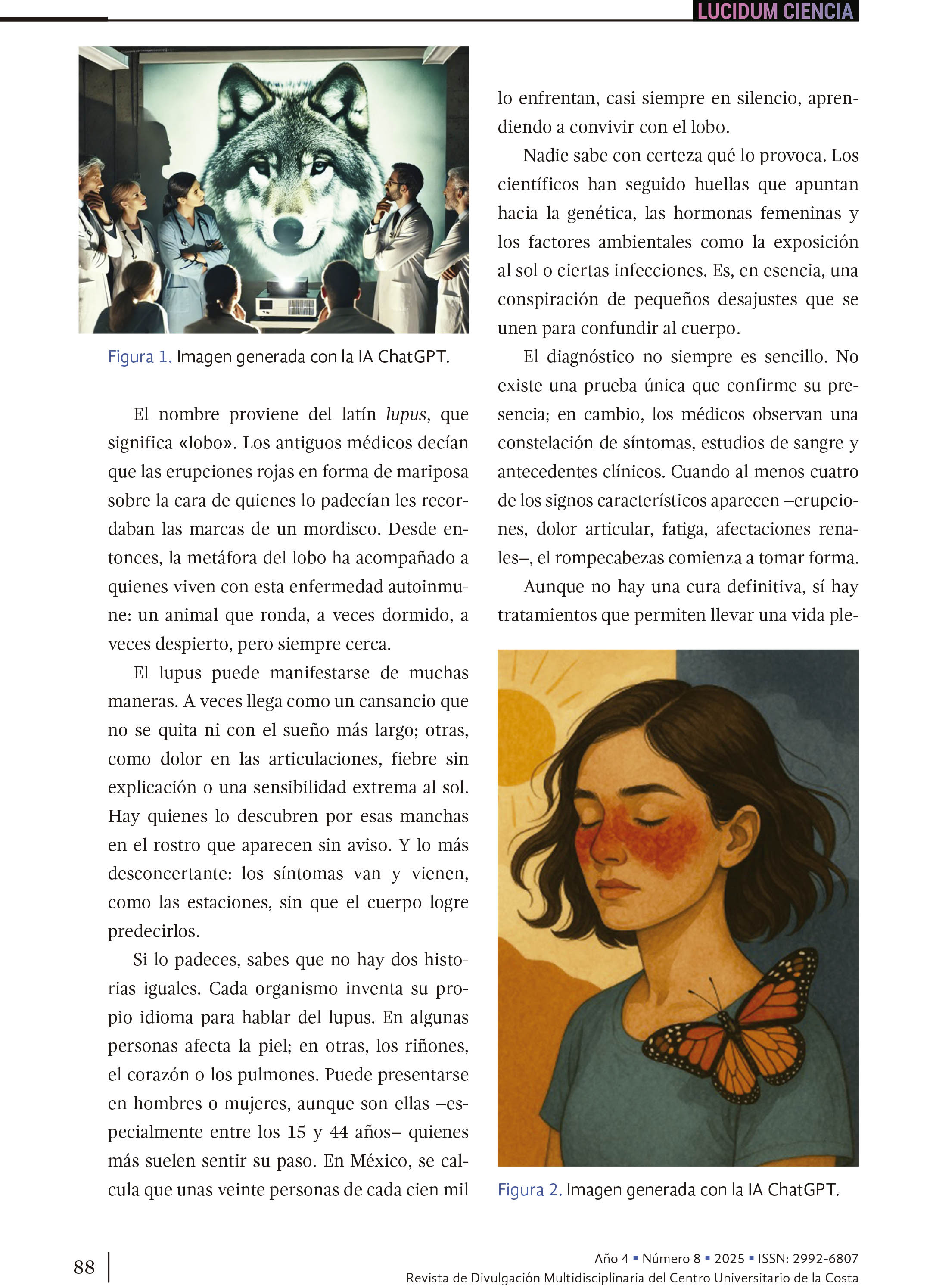 Bajo la sombra del lobo: lo que debes saber sobre el lupus