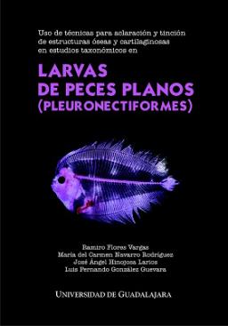 Larvas de peces planos (Pleuronectiformes)